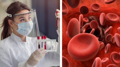 Ensino Einstein Realiza2c Simpb3sio Internacional Em Trombose E Hemostasia